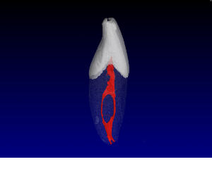 Endodontie